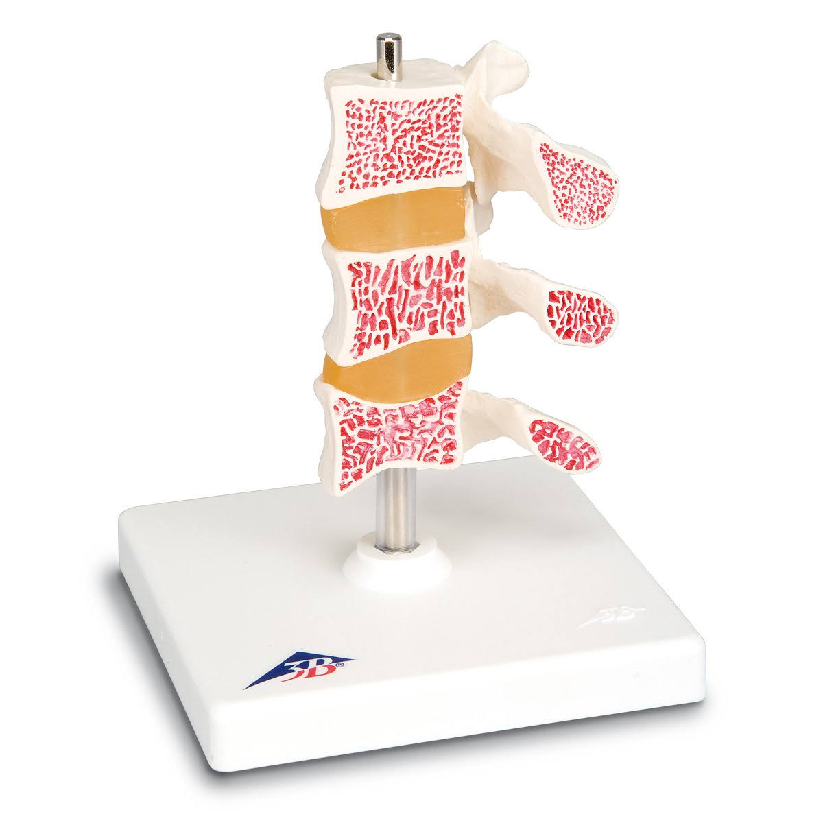 3B Scientific A78 3-Vertebrae Deluxe Osteoporosis Model EY_OH0FBE3P